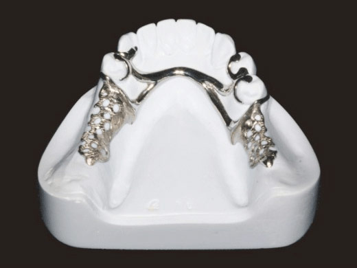 维他灵2000完美支架