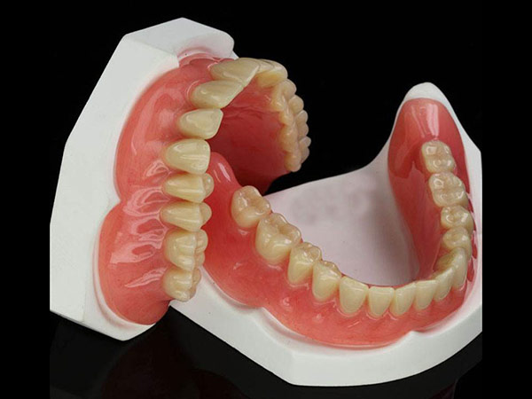 全口吸附性义齿