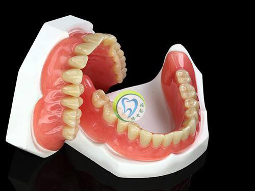 全口吸附性义齿