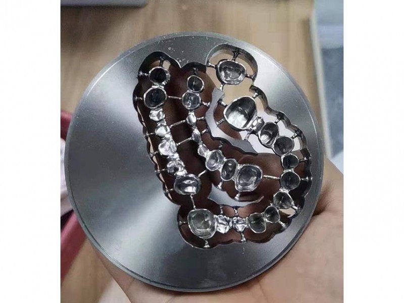 切削纯钛烤瓷牙